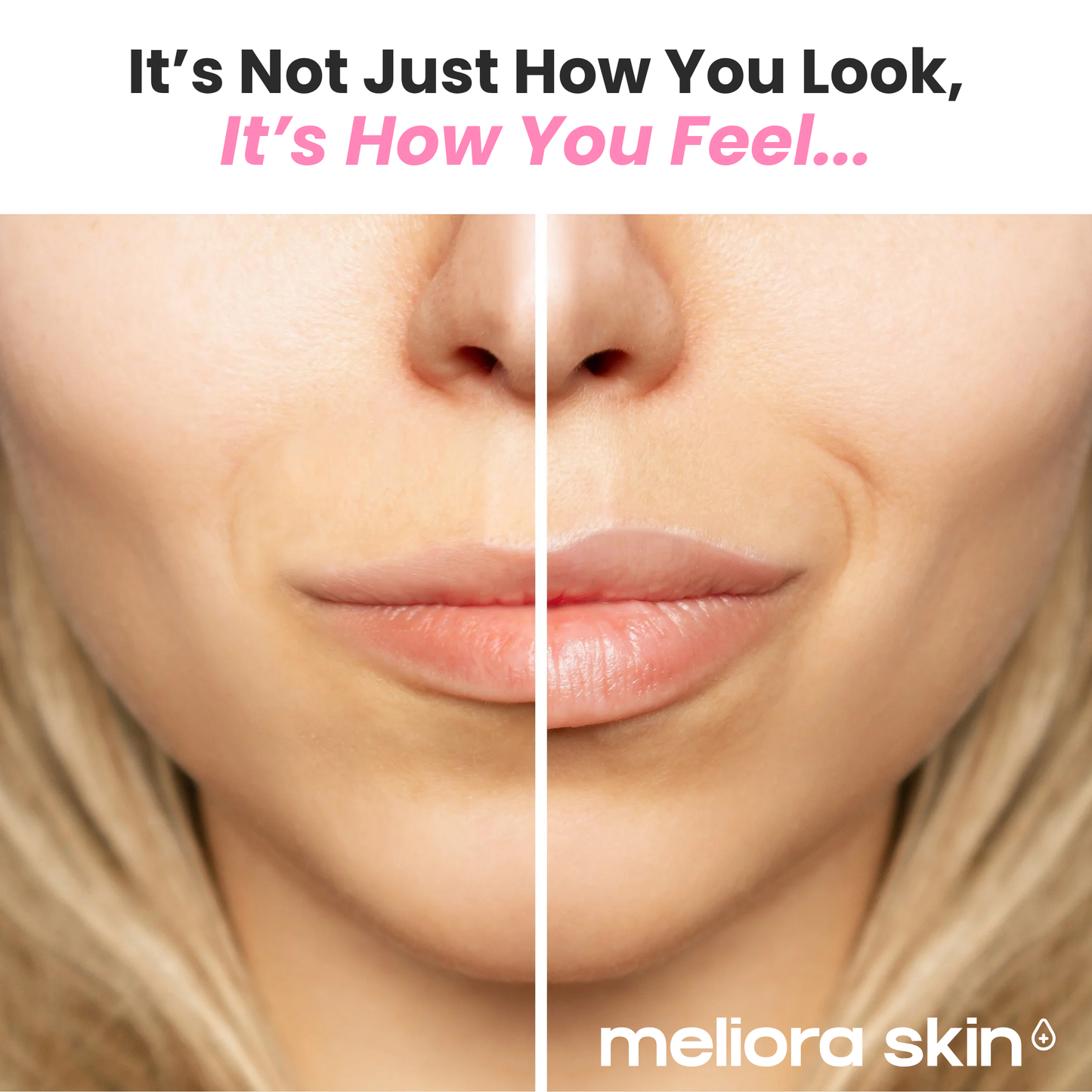 Meliora™ Volume Glow Balm